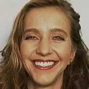 Orthognathic (Jaw) Surgery - After